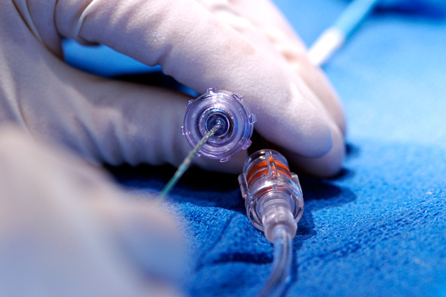 Close-up of a medical professional's gloved hand holding a catheter during a medical procedure.