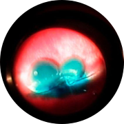 Image of an eye used in studies for our ocular pharmacology studies. The eye is shows in red and blue against a black background.